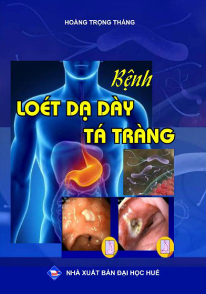 Bệnh Loét Dạ Dày – Tá Tràng